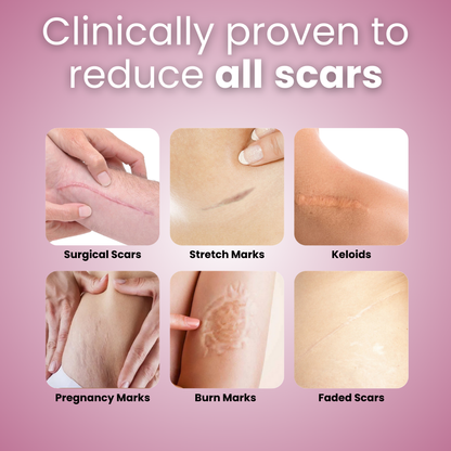 Silora™ - Silicone Scar Tape